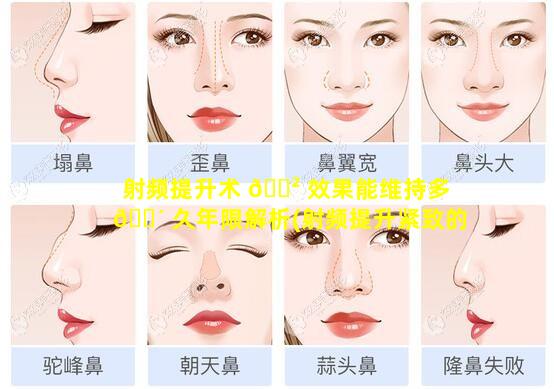 射频提升术 🌲 效果能维持多 🐴 久年限解析(射频提升紧致的价格多少合理)